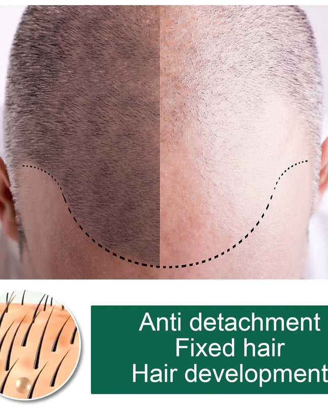 South Moon Hair Growth Spray  Mist