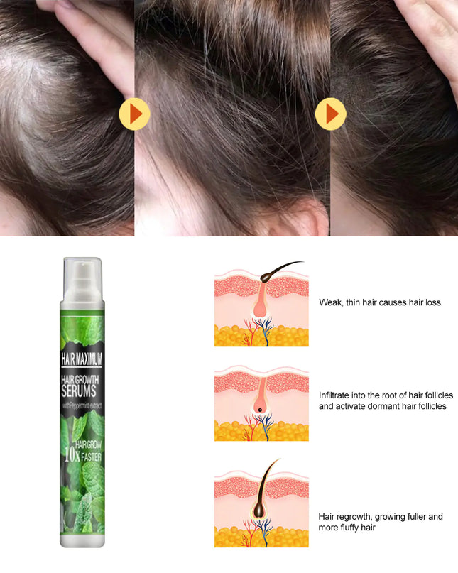 South Moon Hair Growth Spray  Mist