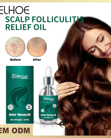 EElhoe Stimulating Hair Growth Serum For All Hair Types
