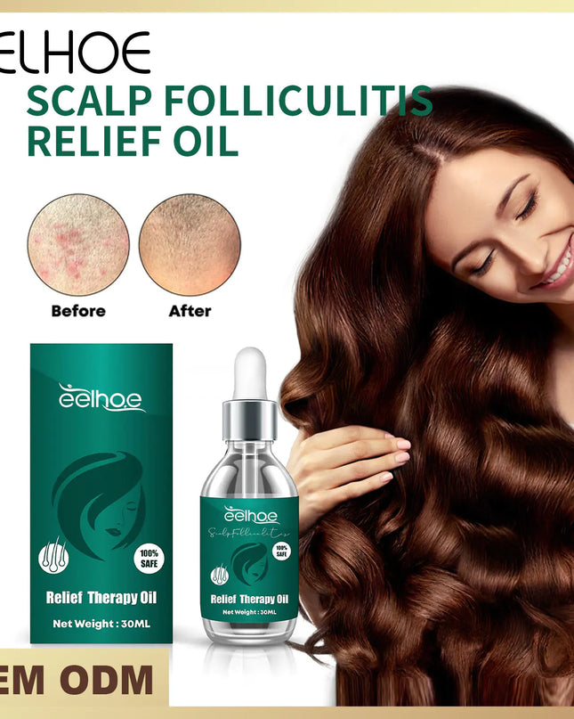 EElhoe Stimulating Hair Growth Serum For All Hair Types