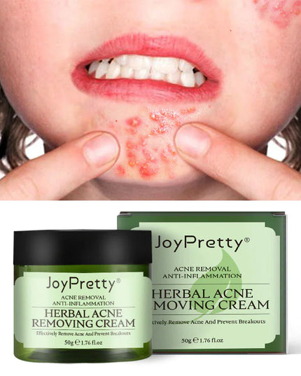 Herbal Acne Cream