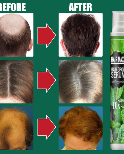 South Moon Hair Growth Spray  Mist