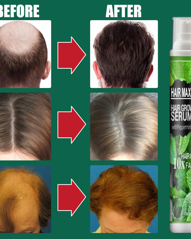 South Moon Hair Growth Spray  Mist