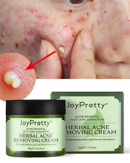 Herbal Acne Cream